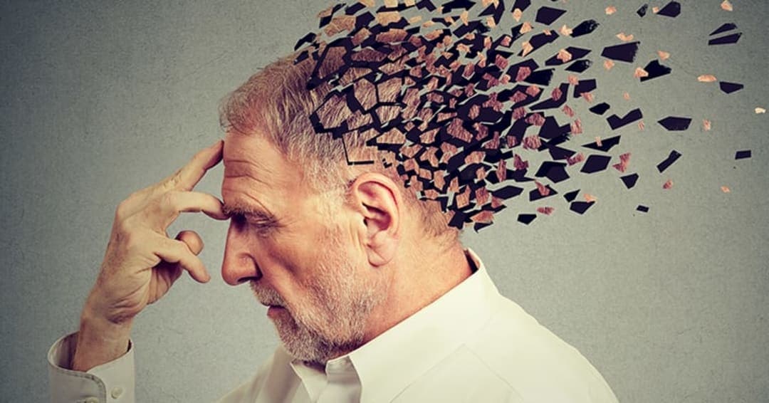 Alzheimer: saiba diferenciar esquecimentos comuns dos sinais que podem indicar a doença